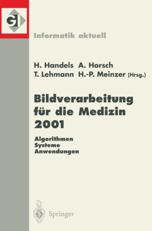 Honighäuschen (Bonn) - The symposium on high salinity tolerant plants, held at the University of Al Ain in December 1990, dealt primarily with plants tolerating salinity levels exceeding that of ocean water and which at the same time are promising for utilization in agriculture or forestry.The papers of the proceedings of this symposium have been published in two volumes. This volume (1) deals with mangroves and inland high salinity tolerant plants and ecosystems and is divided into the following categories: 1. Vegetation analyses and descriptions of mangroves