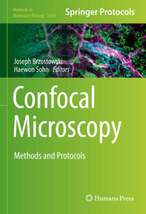 Honighäuschen (Bonn) - This volume provides a wide range of imaging protocols that can be tailored to specific organisms or cell-types. Chapters guide readers through fixed-cell, live-cell, phenotype screening, super-resolution, intravital imaging techniques, and fluorescence life-time imaging microscopy (FLIM). Written in the highly successful Methods in Molecular Biology series format, chapters include introductions to their respective topics, lists of the necessary materials and reagents, step-by-step, readily reproducible laboratory protocols, and tips on troubleshooting and avoiding known pitfalls. Authoritative and cutting-edge, Confocal Microscopy: Methods and Protocols aims to ensure successful results in the further study of this vital field.