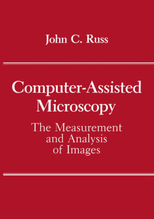 Honighäuschen (Bonn) - The use of computer-based image analysis systems for all kinds of images, but especially for microscope images, has become increasingly widespread in recent years, as computer power has increased and costs have dropped. Software to perform each of the various tasks described in this book exists now, and without doubt additional algorithms to accomplish these same things more efficiently, and to perform new kinds of image processing, feature discrimination and measurement, will continue to be developed. This is likely to be true particularly in the field of three-dimensional imaging, since new microscopy methods are beginning to be used which can produce such data. It is not the intent of this book to train programmers who will assemble their own computer systems and write their own programs. Most users require only the barest of knowledge about how to use the computer, but the greater their understanding of the various image analysis operations which are possible, their advantages and limitations, the greater the likelihood of success in their application. Likewise, the book assumes little in the way of a mathematical background, but the researcher with a secure knowledge of appropriate statistical tests will find it easier to put some of these methods into real use, and have confidence in the results, than one who has less background and experience. Supplementary texts and courses in statistics, microscopy, and specimen preparation are recommended as necessary.