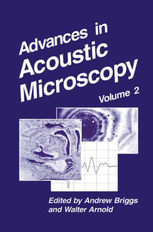 Honighäuschen (Bonn) - This is the second volume of Advances in Acoustic Microscopy. It continues the aim of presenting applications and developments of techniques that are related to high-resolution acoustic imaging. We are very grateful to the authors who have devoted considerable time to preparing these chapters, each of which describes a field of growing importance. Laboratories that have high-performance acoustic microscopes are frequently asked to examine samples for which the highest available resolution is not necessary, and the ability to penetrate opaque layers is more significant. Such applications can be thought of as bridging the gap be tween acoustic microscopy at low gigahertz frequencies, and on the one hand nondestructive testing of materials at low megahertz frequencies and on the other hand medical ultrasonic imaging at low megahertz frequencies. Commercial acoustic microscopes are becoming increasingly available and popular for such applications. We are therefore delighted to be able to begin the volume with chapters from each of those two fields. The first chapter, by Gabriele Pfannschmidt, describes uses of acoustic microscopy in the semiconductor industry. It provides a splendid balance to the opening chapter of Volume 1, which came from a national research center, being written from within a major European electronics industry itself. Dr Pfann schmidt describes the use of two quite different types of acoustic microscopes, and points out the advantages of each for specific purposes.