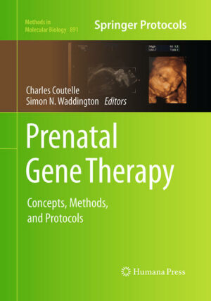 The emerging field of prenatal gene therapy is founded on scientific and technical advances in fetal medicine, molecular biology and gene therapy. This preclinical research subject aims at applying gene therapy during pregnancy for the prevention of human diseases caused by early onset congenital or gestation related conditions. In Prenatal Gene Therapy: Concepts, Methods and Protocols, expert researchers in the field detail many of the protocols which are now commonly used to study gene therapy, fetal medicine and medical ethics. These include detailed protocols for vector production, for breeding and husbandry of the animal models, for the surgical procedures of gene delivery in large and small animals and for the methods of gene transfer analysis. Written in the highly successful Methods in Molecular Biology series format, chapters include introductions to their respective topics, lists of the necessary materials and reagents, step-by-step, readily reproducible laboratory protocols, and key tips on troubleshooting and avoiding known pitfalls. Thorough and intuitive, Prenatal Gene Therapy: Concepts, Methods and Protocols seeks to aid scientists in the further study of prenatal disease and gene therapy projects beyond the scope of fetal medicine.