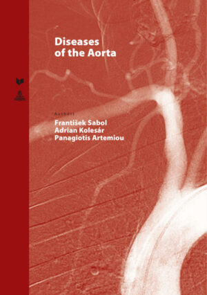 Honighäuschen (Bonn) - The book comprehensively summarizes current knowledge on albeit uncommon, but serious aortic diseases. Until now, diseases of the aorta were part of texts from the area of internal medicine, angiology, imaging methods, vascular surgery and cardiac surgery. The importance and need for a publication with a cross-specialty reach is demonstrated in day-to-day practice. Due to the improvements in diagnostic methods and subsequent earlier diagnosis, patients with some of these aortic diseases are no longer a rarity and it is expected that with the increase in survival rates, we will be encountering them more often. A chapter on aneurysm etiology presents an overview of all etiological groups, allowing the reader to become versed in the topic, while pointing out the less known aneurysm causes.