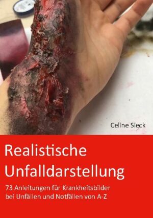 Honighäuschen (Bonn) - Dieses Buch ist für alle geeignet, die Unfallübungen noch realistischer und besser aussehen lassen wollen. Das Buch zeigt, wie man verschiedene Verletzungen und Krankheitsbilder von A-Z schminken kann. Dabei ist es egal, ob du ein Anfänger oder schon Fortgeschrittener bist, da alles sehr einfach erklärt wird. Alles was du dafür brauchst, wird aufgezählt und dann kann es schon ans Schminken gehen. In dem Buch ist alles sehr übersichtlich in Tabellen aufgeschrieben. Dabei gibt es die Kategorien Schminken, Schauspielern und welches Material man braucht. Außerdem werden die Vitalwerte aufgezählt, die der Patient in der Situation hat oder bekommen kann. Dieses dient dazu, dass man sie entweder auf den medizinischen Geräten steuern oder diese den Helfern mitteilen kann. Alles zusammen hilft, die Einsatzkräfte bestmöglich realistisch üben zu lassen, damit sie in Einsatzsituationen bestens vorbereitet sind und somit noch besser reagieren können. In dem Buch sind außerdem mehrere Beispielbilder, damit man es sich besser vorstellen kann, wie die einzelnen Verletzungen fertig geschminkt aussehen können.