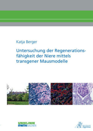 Akute wie chronische Schädigungen der Niere haben weitreichende Folgen für den gesamten Organismus und resultieren in einer deutlich erhöhten Morbidität und Mortalität. Die therapeutischen Maßnahmen sind limitiert und greifen selten am eigentlichen Krankheitsauslöser an. Die Nierentubuli verfügen über ein hohes Potenzial nach einem akuten Schaden zu regenerieren, was für die Entwicklung einer Therapie bedeutsam ist. Daher wurden regenerative Mechanismen im Tubulus sowie im Glomerulus untersucht.