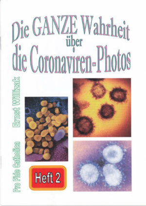 Honighäuschen (Bonn) - Wie sieht eine echte elektronenmikroskopische Aufnahme aus - und wie nicht? Wie müßte ein echtes Virus unter dem Elektronenmikroskop aussehen - und wie nicht? Echte elektronenmikroskopische Photos sind niemals farbig. Unmögliche "Corona-Viren" - Erlogene Bildunterschriften. Das Robert-Koch-Institut im Zwielicht.